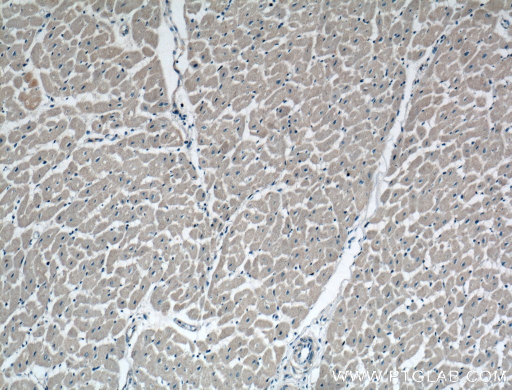 Immunohistochemistry (IHC) staining of human heart tissue using DUT Polyclonal antibody (13740-1-AP)