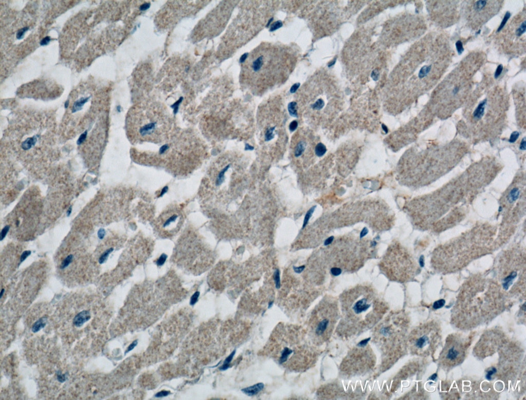 Immunohistochemistry (IHC) staining of human heart tissue using DUT Polyclonal antibody (13740-1-AP)