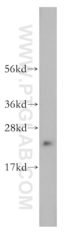 Western Blot (WB) analysis of human kidney tissue using DUT Polyclonal antibody (13740-1-AP)