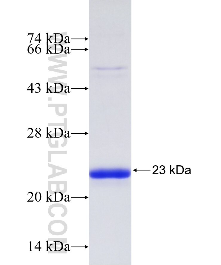 DUT fusion protein Ag30799 SDS-PAGE DUT fusion protein Ag30799 SDS-PAGE