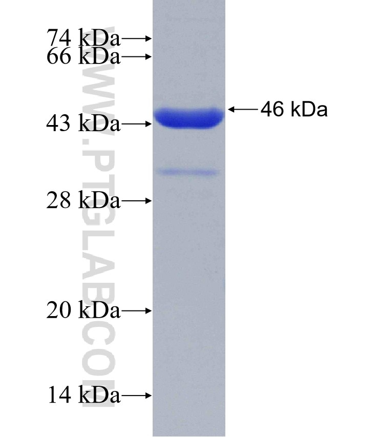 DUT fusion protein Ag4677 SDS-PAGE