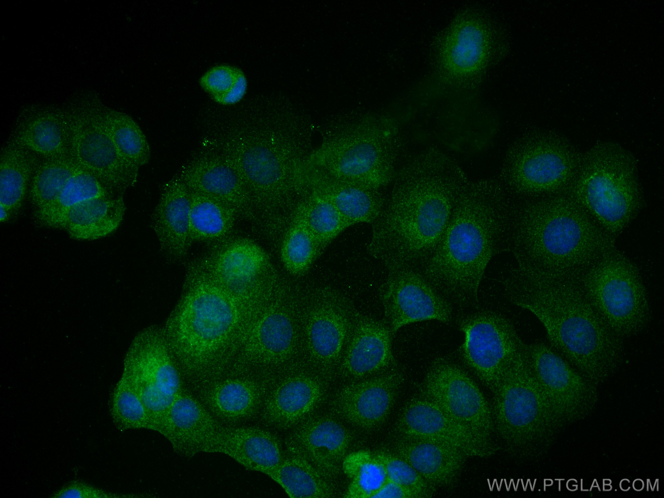Immunofluorescence (IF) / fluorescent staining of MCF-7 cells using DVL1 Polyclonal antibody (27384-1-AP)