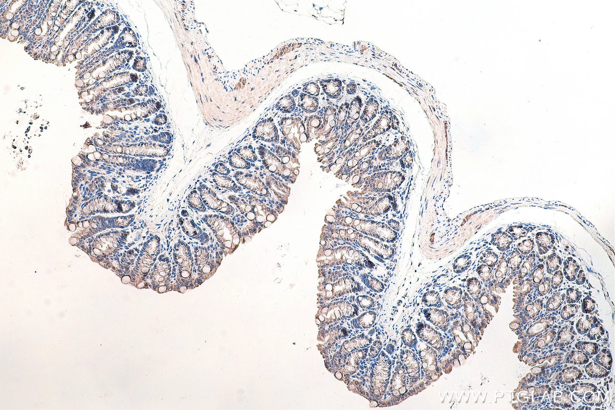 Immunohistochemistry (IHC) staining of mouse colon tissue using DVL1 Polyclonal antibody (27384-1-AP)