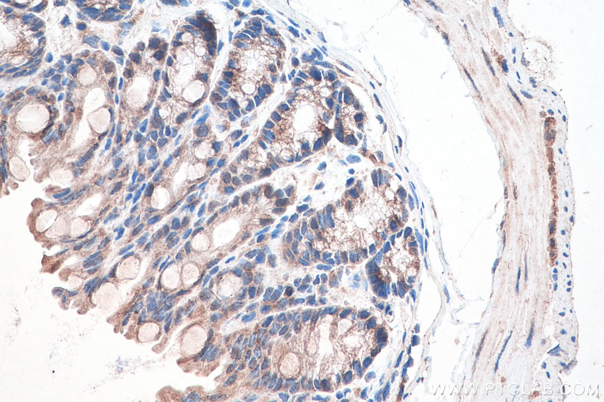 Immunohistochemistry (IHC) staining of mouse colon tissue using DVL1 Polyclonal antibody (27384-1-AP)