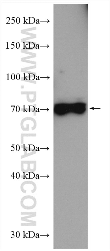 Western Blot (WB) analysis of mouse cerebellum tissue using DVL1 Polyclonal antibody (27384-1-AP)