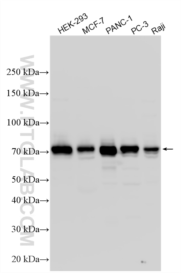 Western Blot (WB) analysis of various lysates using DVL1 Polyclonal antibody (27384-1-AP)