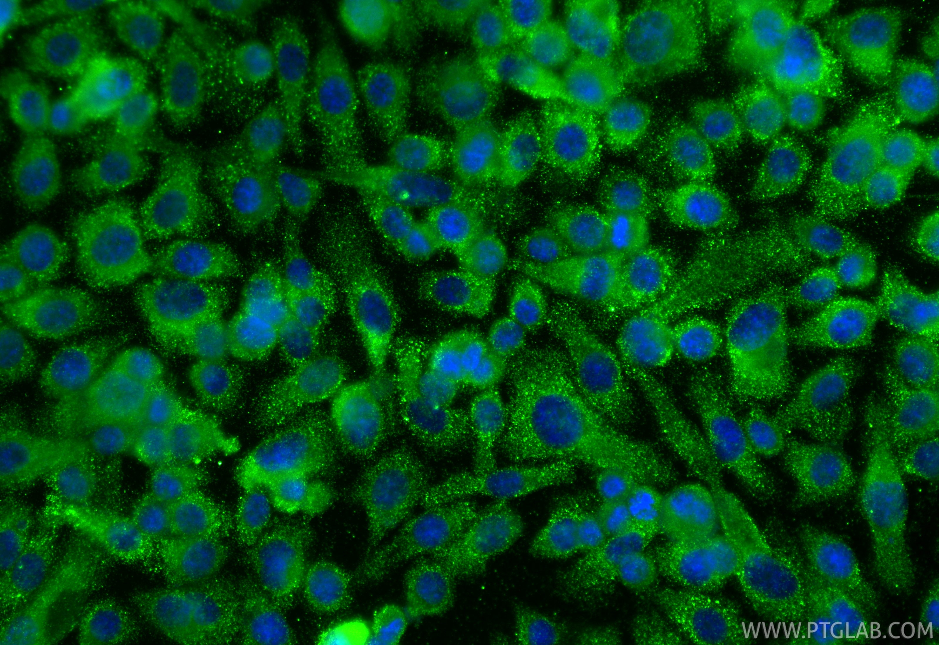 Immunofluorescence (IF) / fluorescent staining of PC-3 cells using DVL1 Monoclonal antibody (67672-1-Ig)