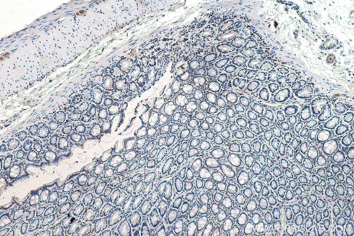 Immunohistochemistry (IHC) staining of rat colon tissue using DVL1 Monoclonal antibody (67672-1-Ig)