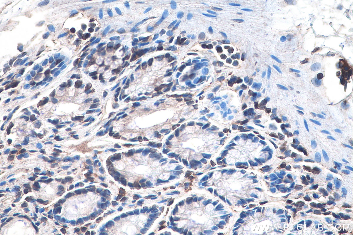Immunohistochemistry (IHC) staining of rat colon tissue using DVL1 Monoclonal antibody (67672-1-Ig)