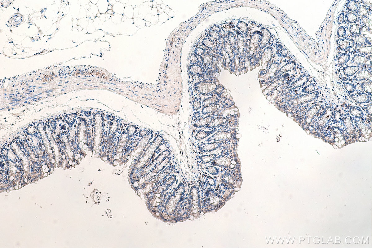 IHC staining of mouse colon using 67672-1-Ig