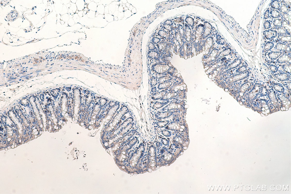 Immunohistochemistry (IHC) staining of mouse colon tissue using DVL1 Monoclonal antibody (67672-1-Ig)