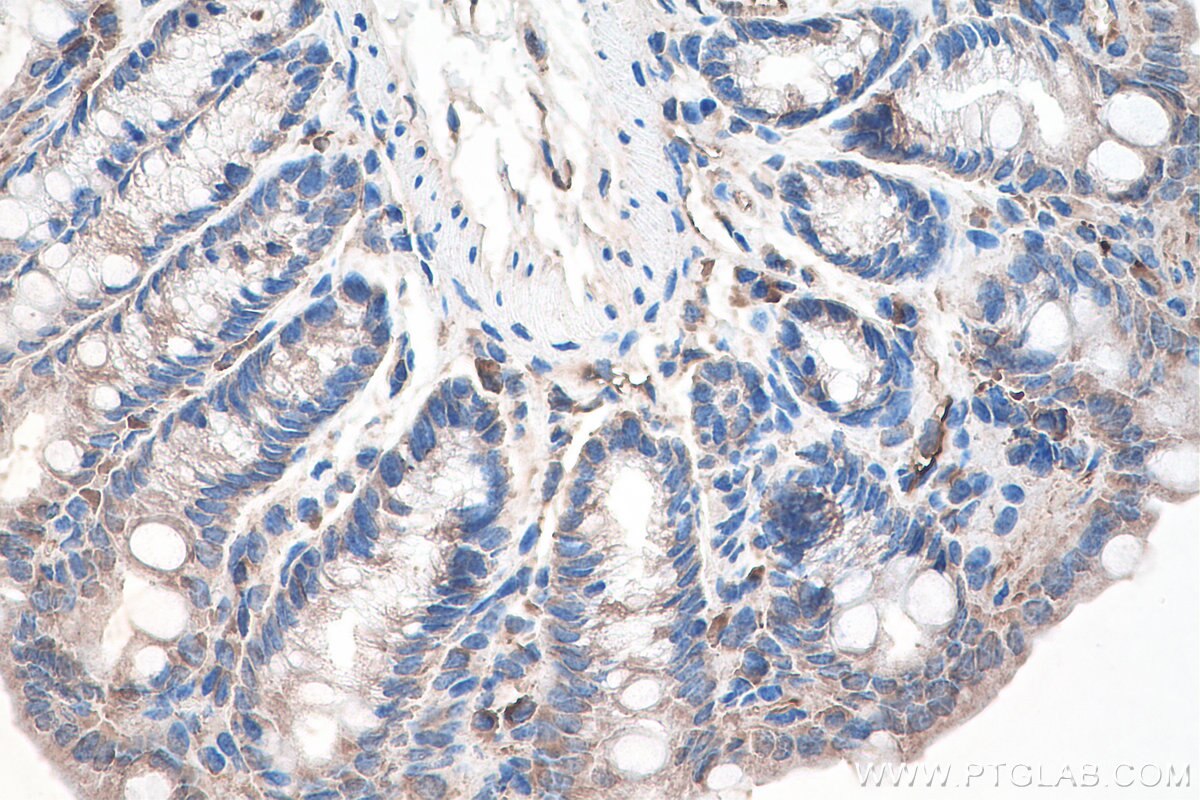 Immunohistochemistry (IHC) staining of mouse colon tissue using DVL1 Monoclonal antibody (67672-1-Ig)