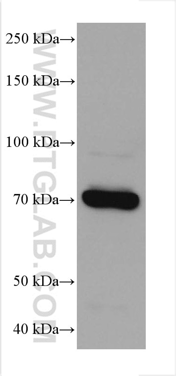 Western Blot (WB) analysis of NCCIT cells using DVL1 Monoclonal antibody (67672-1-Ig)