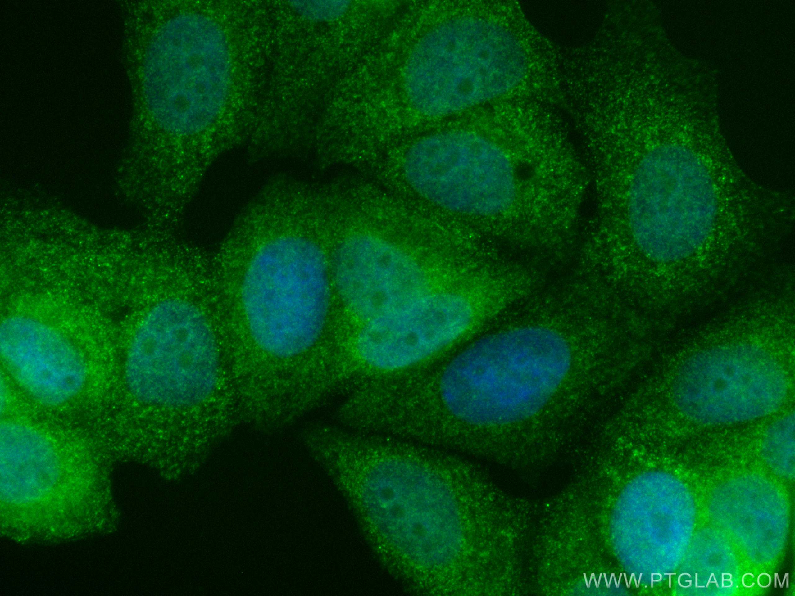 Immunofluorescence (IF) / fluorescent staining of MCF-7 cells using CoraLite® Plus 488-conjugated DVL1 Polyclonal anti (CL488-27384)