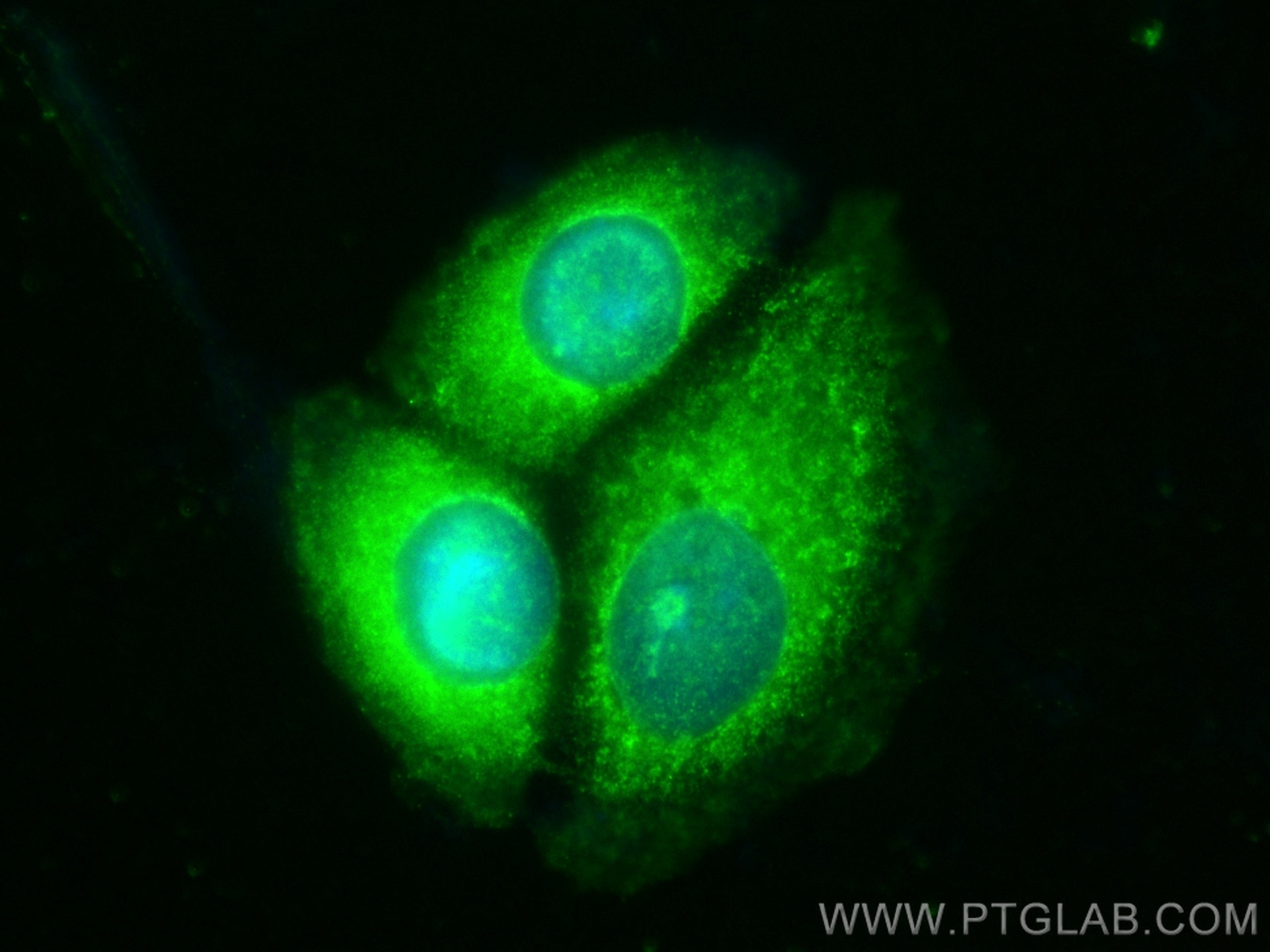 Immunofluorescence (IF) / fluorescent staining of MCF-7 cells using CoraLite® Plus 488-conjugated DVL1 Monoclonal anti (CL488-67672)