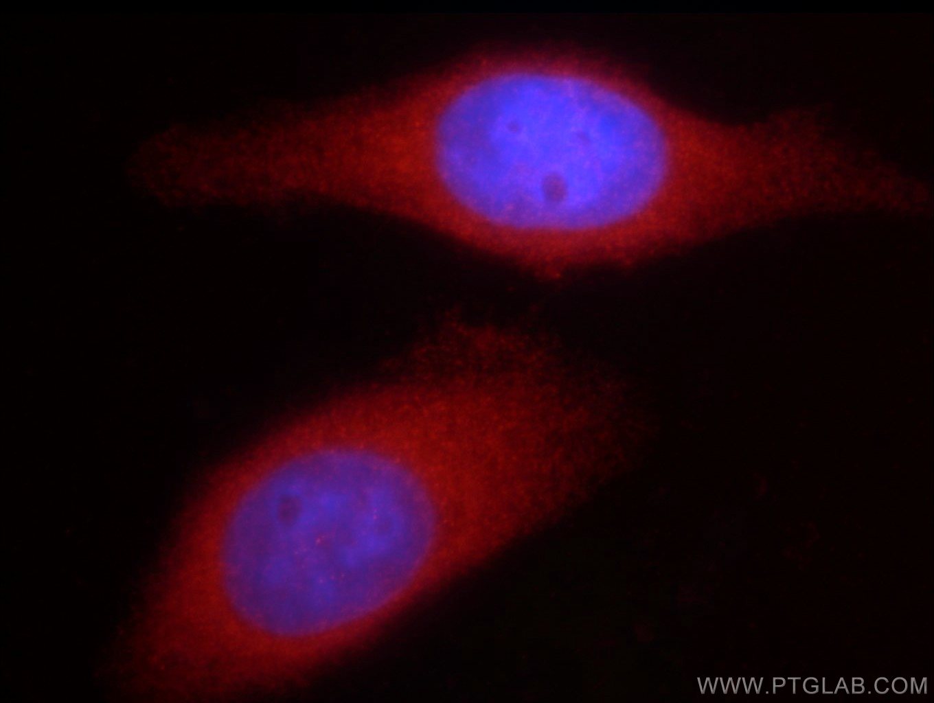 Immunofluorescence (IF) / fluorescent staining of HepG2 cells using DVL2 Polyclonal antibody (12037-1-AP)