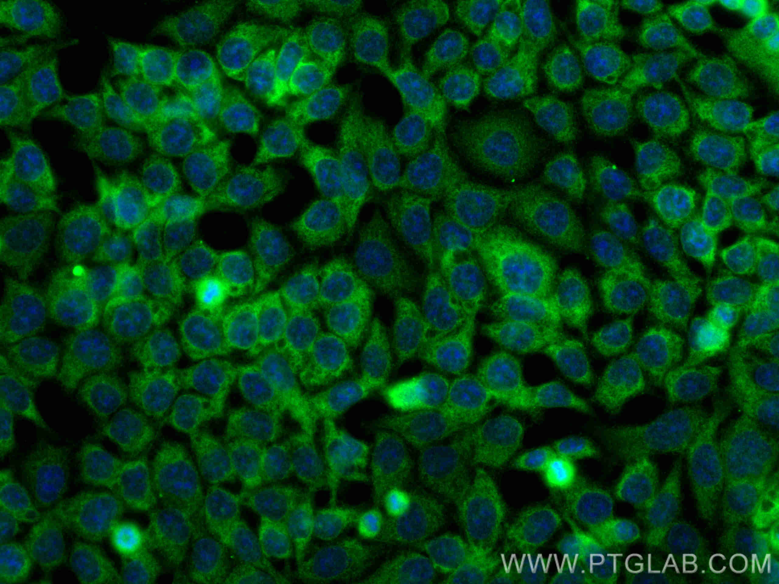 Immunofluorescence (IF) / fluorescent staining of HCT 116 cells using DVL2 Polyclonal antibody (12037-1-AP)