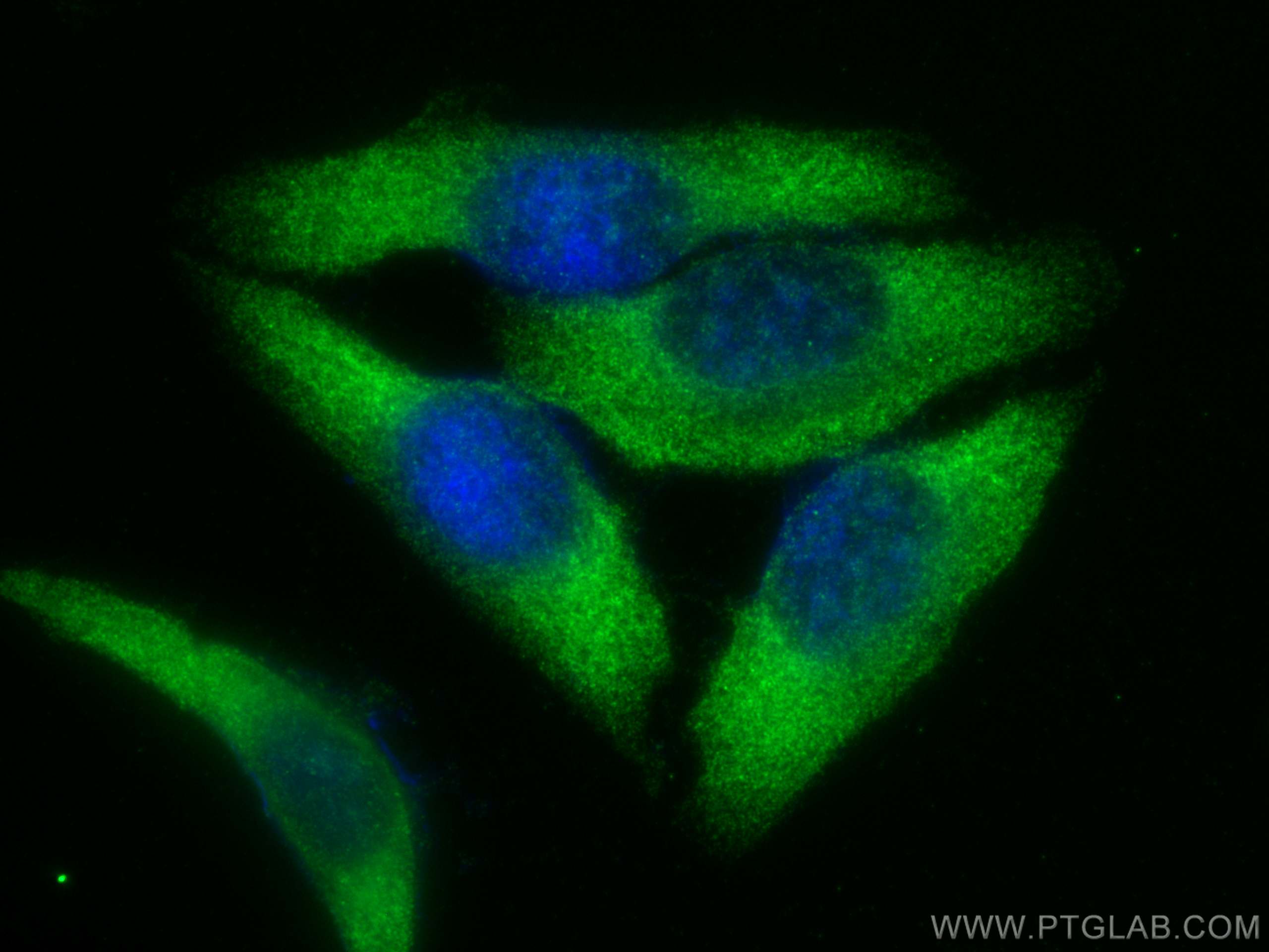 Immunofluorescence (IF) / fluorescent staining of HepG2 cells using DVL2 Polyclonal antibody (12037-1-AP)