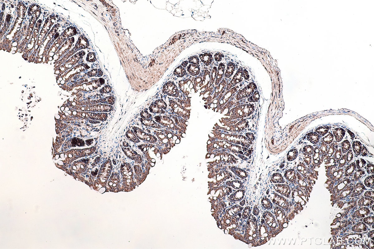 IHC staining of mouse colon using 12037-1-AP
