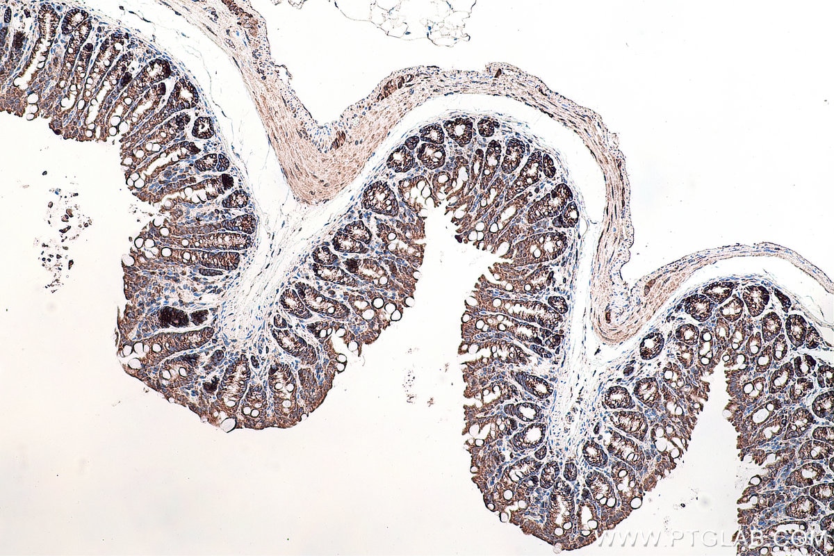 Immunohistochemistry (IHC) staining of mouse colon tissue using DVL2 Polyclonal antibody (12037-1-AP)