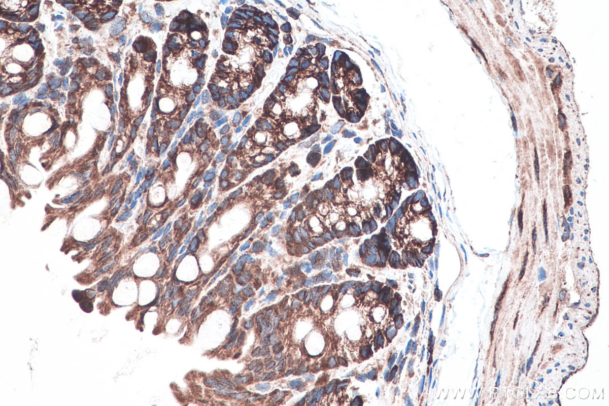 Immunohistochemistry (IHC) staining of mouse colon tissue using DVL2 Polyclonal antibody (12037-1-AP)