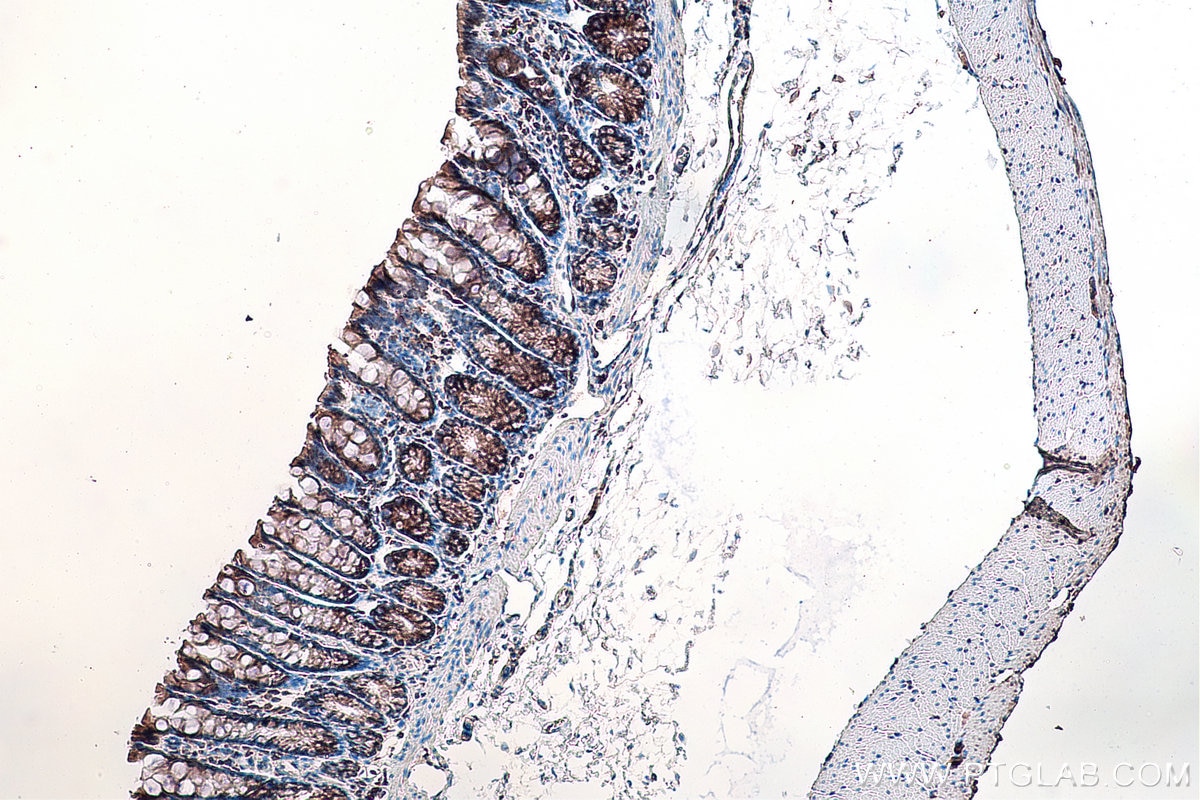 Immunohistochemistry (IHC) staining of rat colon tissue using DVL2 Polyclonal antibody (12037-1-AP)
