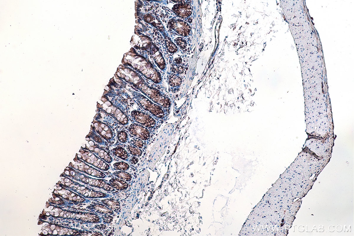 IHC staining of rat colon using 12037-1-AP