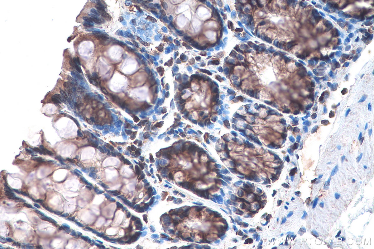 Immunohistochemistry (IHC) staining of rat colon tissue using DVL2 Polyclonal antibody (12037-1-AP)