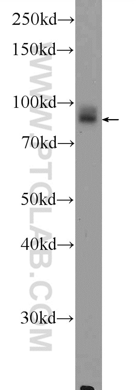 Western Blot (WB) analysis of MCF-7 cells using DVL2 Polyclonal antibody (12037-1-AP)