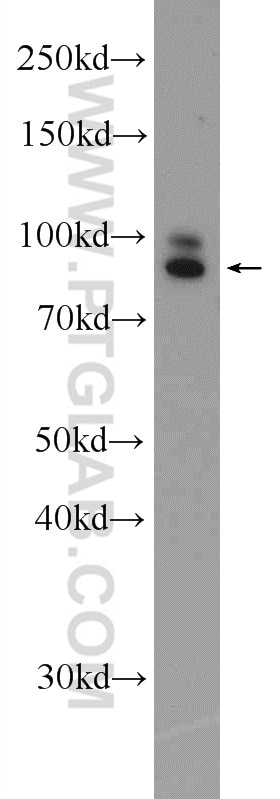 Western Blot (WB) analysis of MDA-MB-453s cells using DVL2 Polyclonal antibody (12037-1-AP)