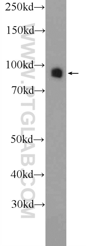 DVL2 Polyclonal antibody