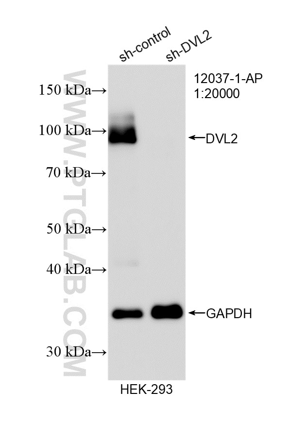 Western Blot (WB) analysis of HEK-293 cells using DVL2 Polyclonal antibody (12037-1-AP)