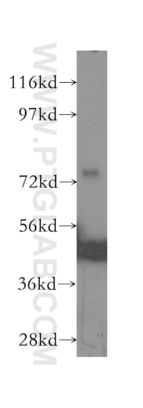 Western Blot (WB) analysis of mouse thymus tissue using DVL2 Polyclonal antibody (12037-1-AP)