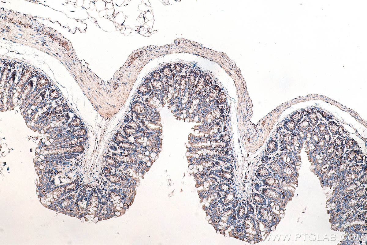 IHC staining of mouse colon using 67105-1-Ig