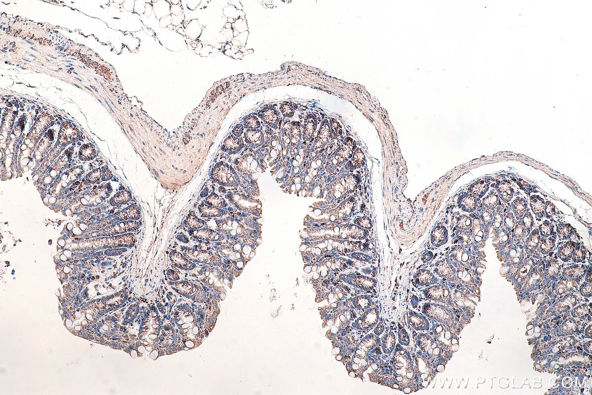 Immunohistochemistry (IHC) staining of mouse colon tissue using DVL2 Monoclonal antibody (67105-1-Ig)