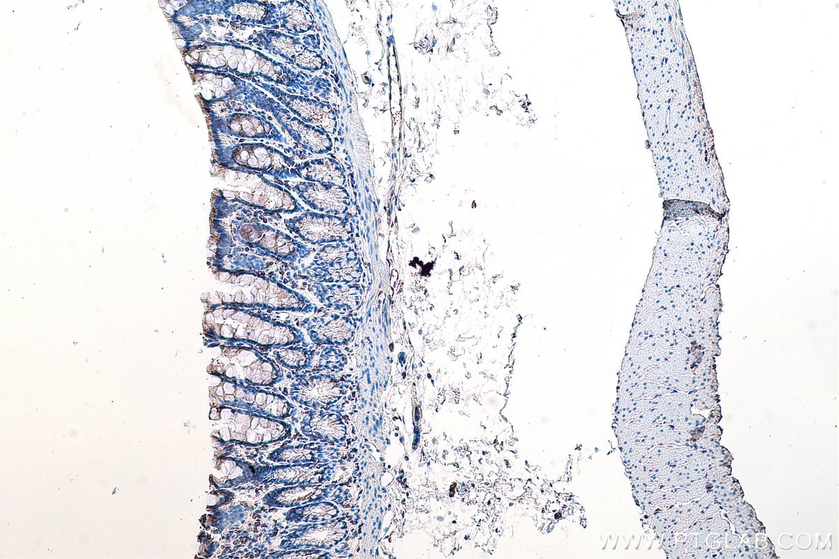 Immunohistochemistry (IHC) staining of rat colon tissue using DVL2 Monoclonal antibody (67105-1-Ig)