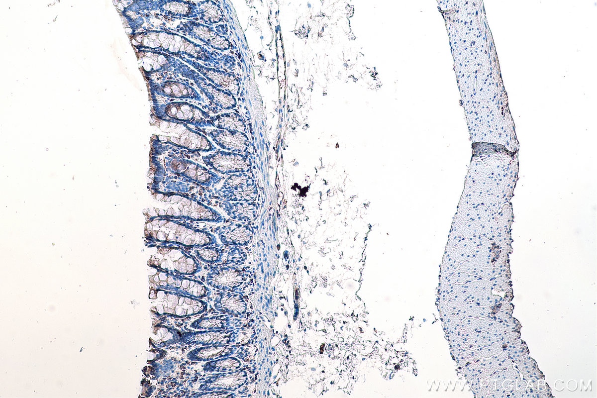 IHC staining of rat colon using 67105-1-Ig