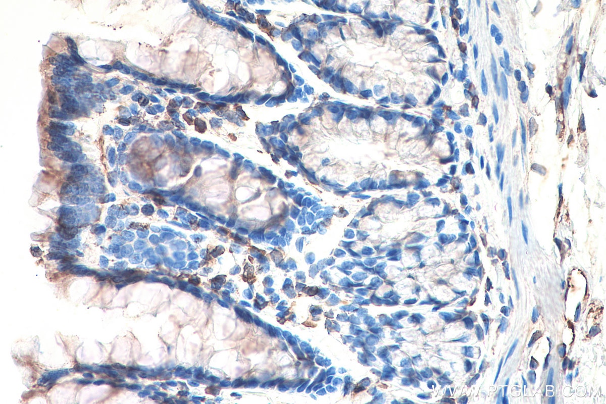 Immunohistochemistry (IHC) staining of rat colon tissue using DVL2 Monoclonal antibody (67105-1-Ig)