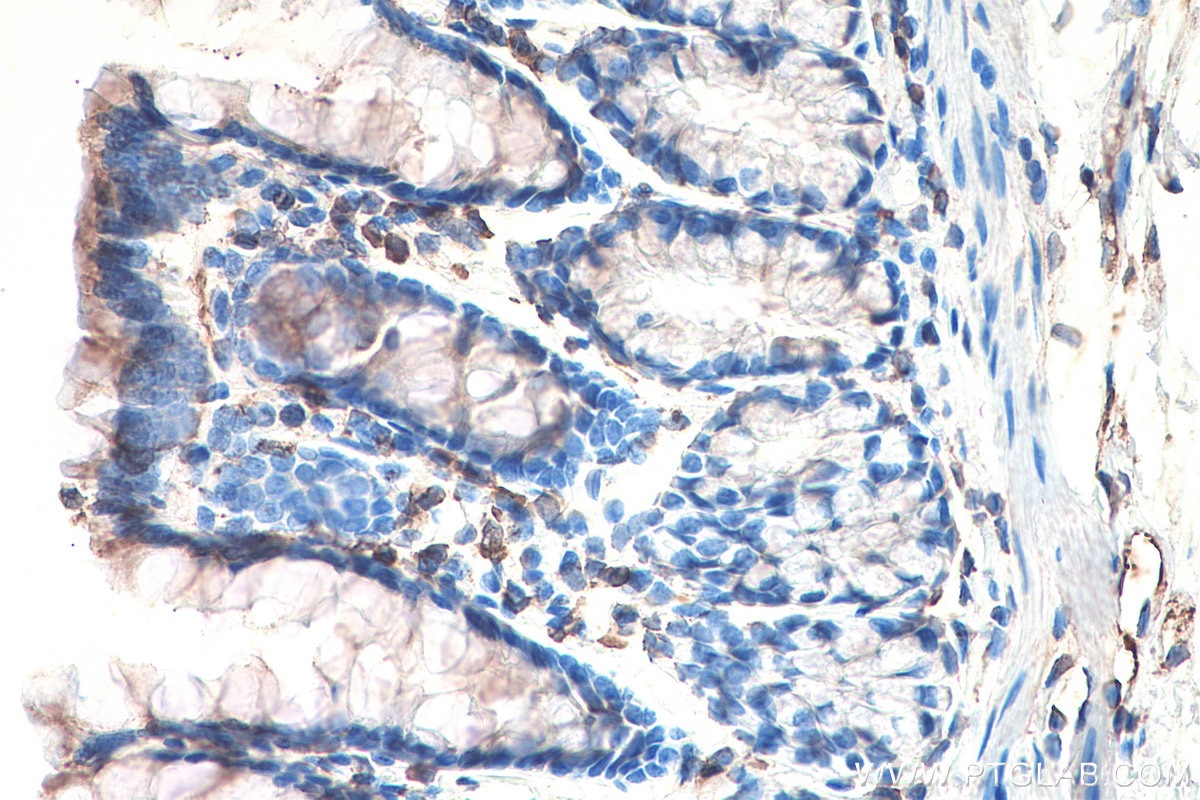 IHC staining of rat colon using 67105-1-Ig