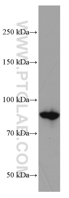 Western Blot (WB) analysis of A431 cells using DVL2 Monoclonal antibody (67105-1-Ig)