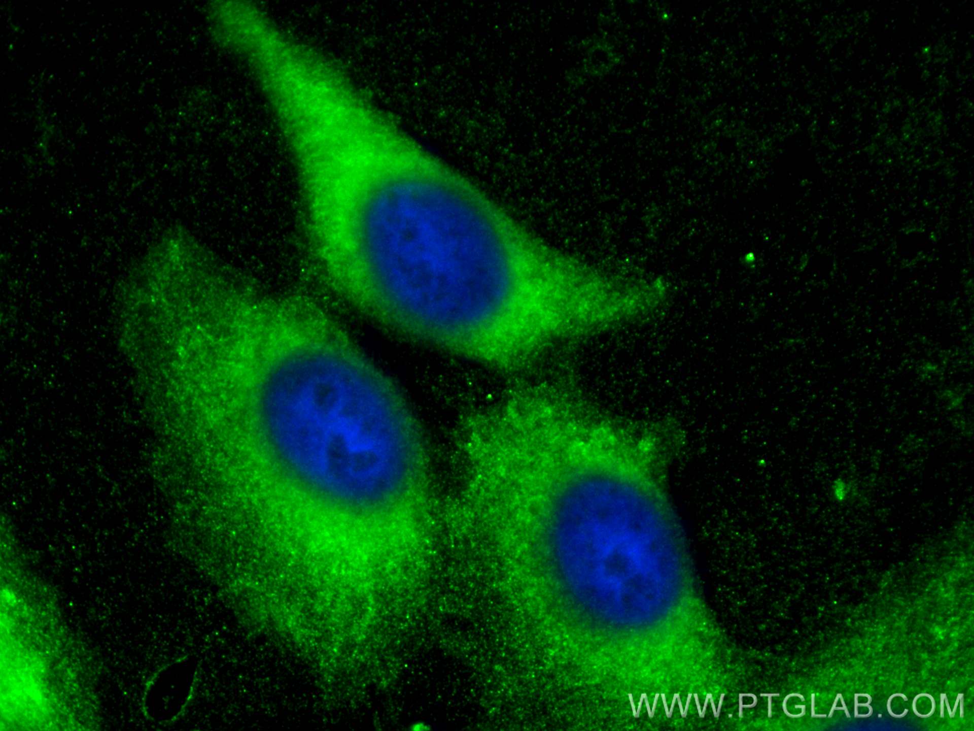 Immunofluorescence (IF) / fluorescent staining of HepG2 cells using CoraLite® Plus 488-conjugated DVL2 Polyclonal anti (CL488-12037)