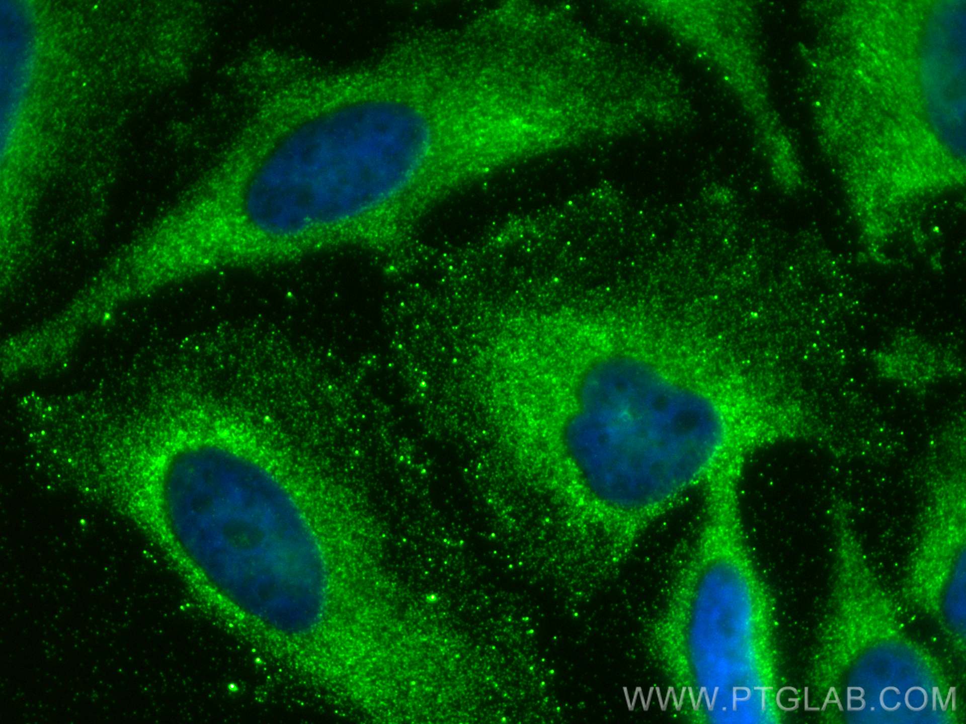 Immunofluorescence (IF) / fluorescent staining of HeLa cells using DVL3 Polyclonal antibody (13444-1-AP)