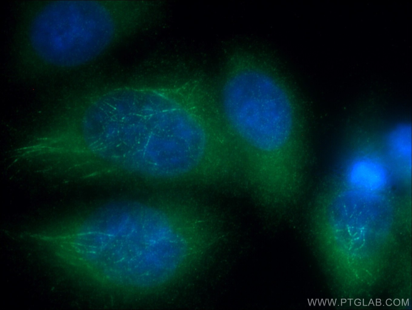 Immunofluorescence (IF) / fluorescent staining of HeLa cells using DVL3 Polyclonal antibody (13444-1-AP)