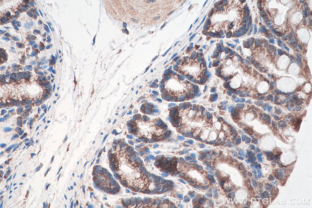 Immunohistochemistry (IHC) staining of mouse colon tissue using DVL3 Polyclonal antibody (13444-1-AP)