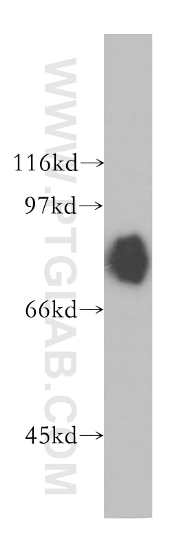Western Blot (WB) analysis of MCF-7 cells using DVL3 Polyclonal antibody (13444-1-AP)