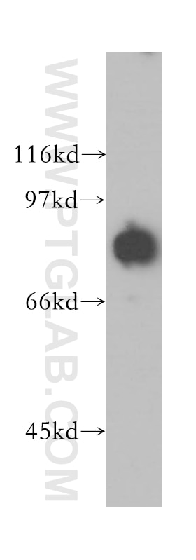 DVL3 Polyclonal antibody