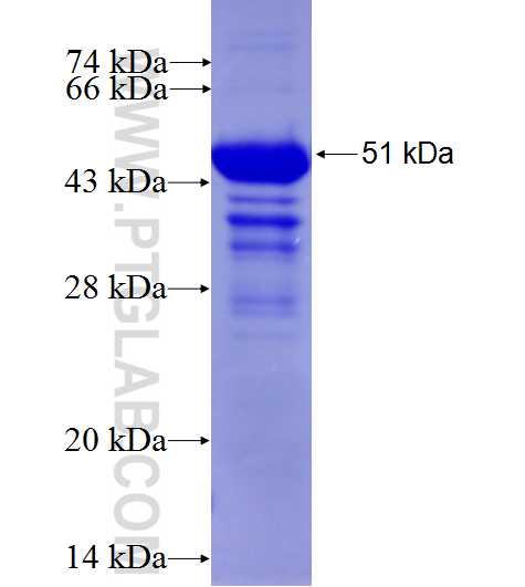 DVL3 fusion protein Ag4451 SDS-PAGE