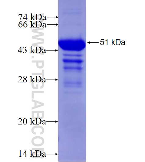 DVL3 fusion protein Ag4451 SDS-PAGE