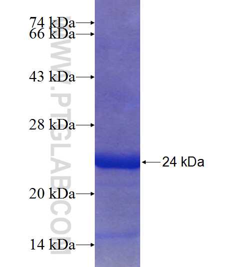 DYDC1 fusion protein Ag23718 SDS-PAGE