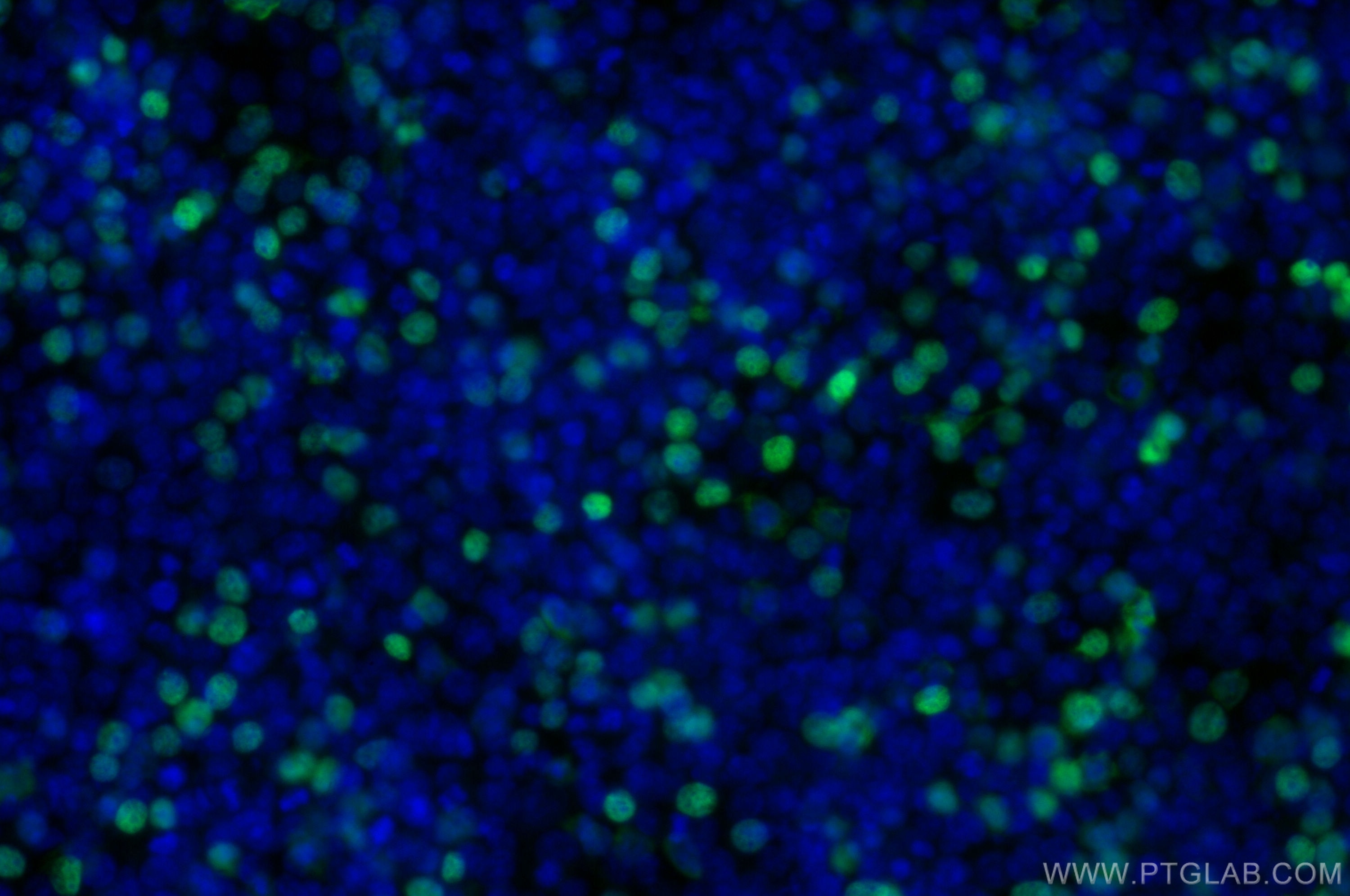 Immunofluorescence (IF) / fluorescent staining of Transfected HEK-293 cells using CoraLite® Plus 488-conjugated DYKDDDDK tag Recombi (CL488-80801-2)